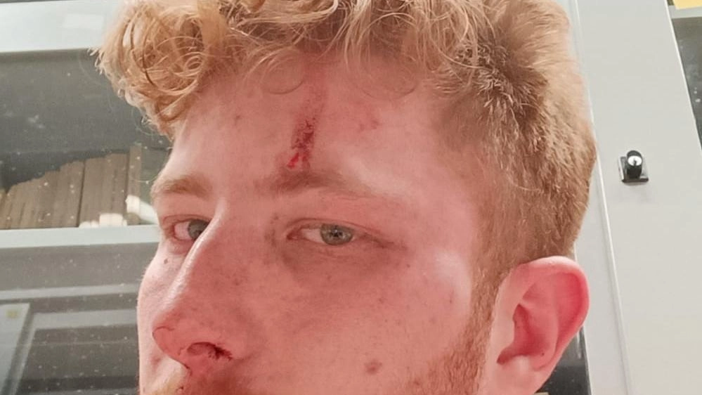 È arrivata in Consiglio comunale l’aggressione subita dall’universitario Roberto Buzzi (nella foto). Presente un gruppo di ragazzi, il vicepresidente...