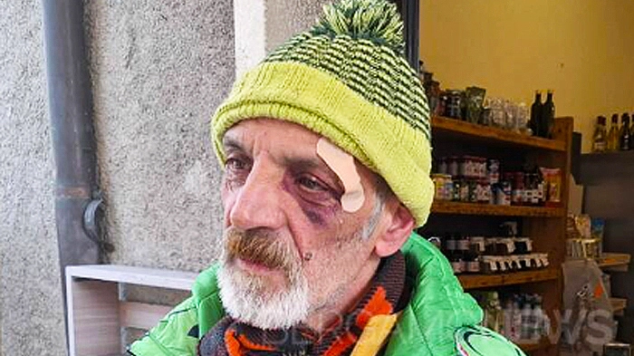 Gaetano Calì, 62 anni Gaetano Calì, 62 anni