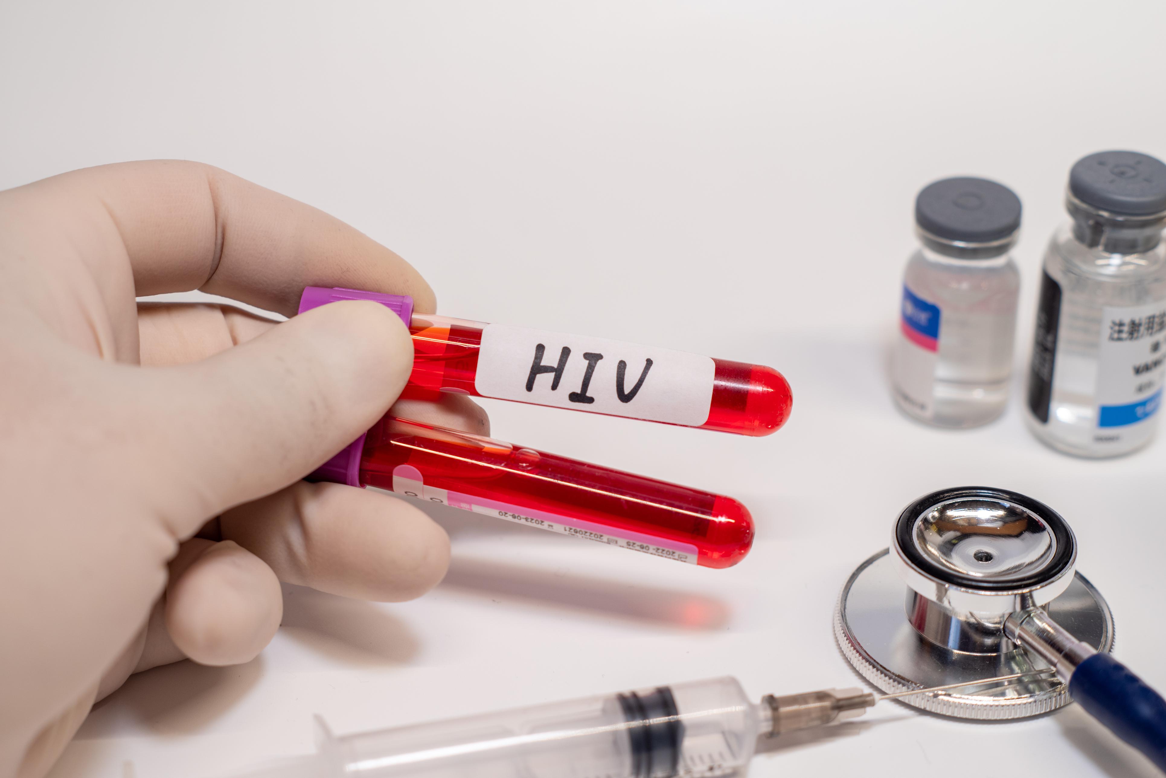 Test rapidi e gratis per Hiv, epatiti virali e infezioni sessualmente trasmissibili a Milano e Como: quando e dove Test rapidi e gratis per Hiv, epatiti virali e infezioni sessualmente trasmissibili a Milano e Como: quando e dove