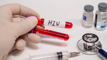 Test rapidi e gratis per Hiv, epatiti virali e infezioni sessualmente trasmissibili a Milano e Como: quando e dove