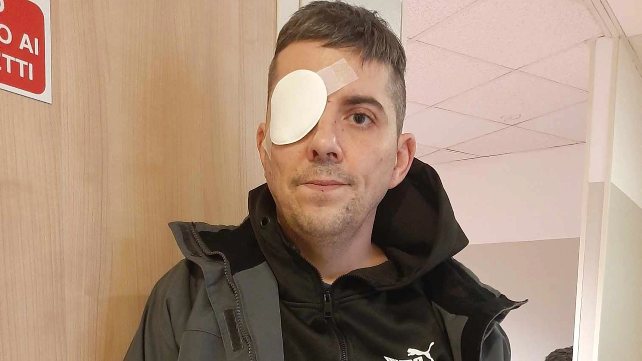 Gabriele Granata, 38 anni, padre di due figli ha perso un occhio dopo l'aggressione