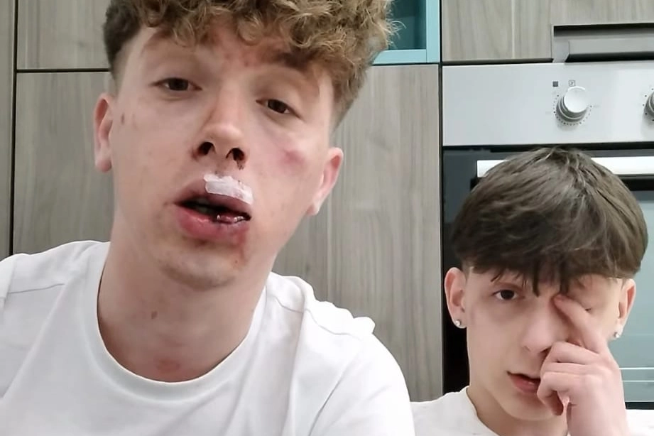 Andrea Bianchi (a sinistra) ha pubblicato sul suo profilo Instagram un video in cui racconta quel che gli è capitato