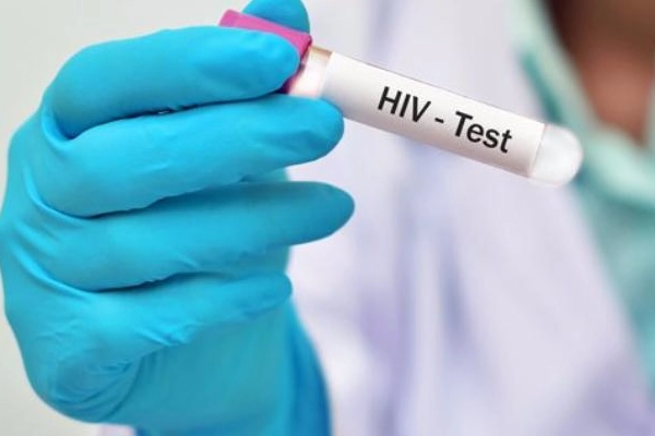 Test per il virus Hiv