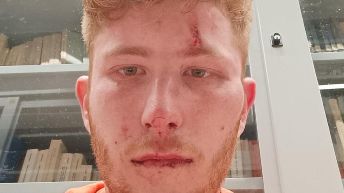sei uno sporco fascista parla roberto buzzi lo studente di destra vittima dell agguato in università a pavia picchiatori in giacca e cravatta