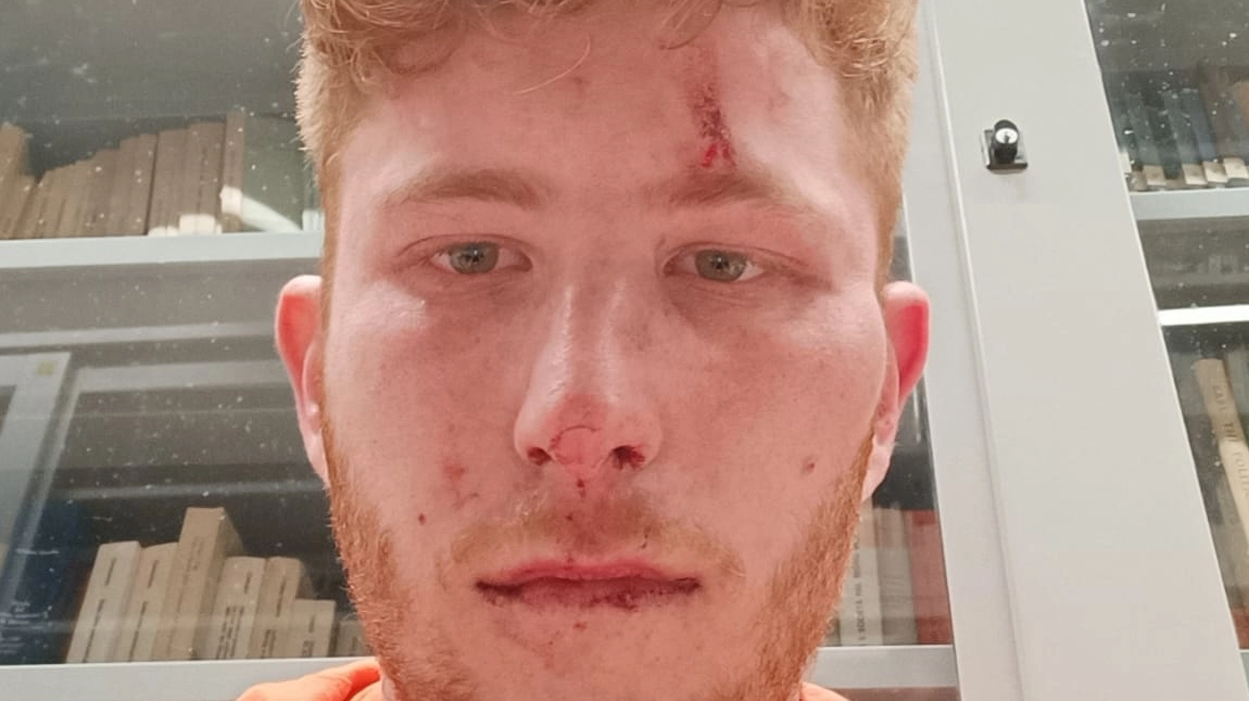 Parla Roberto Buzzi, lo studente di destra vittima dell'agguato in università: “Mi hanno detto: ‘sporco fascista’. Picchiatori in giacca e cravatta”