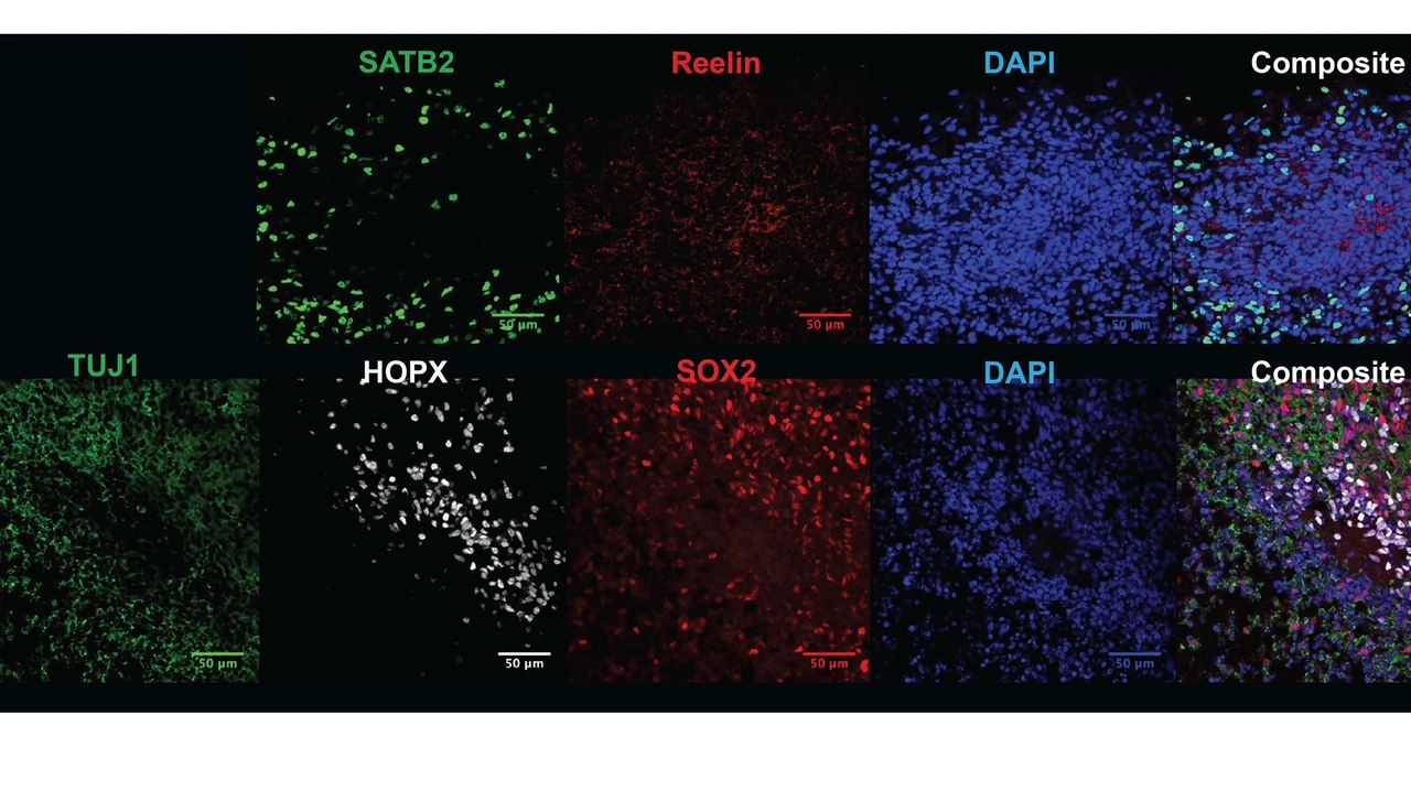 ‘Organoidi mosaico’: nuove tecnologie per studiare il cervello umano su più individui contemporaneamente ‘Organoidi mosaico’: nuove tecnologie per studiare il cervello umano su più individui contemporaneamente