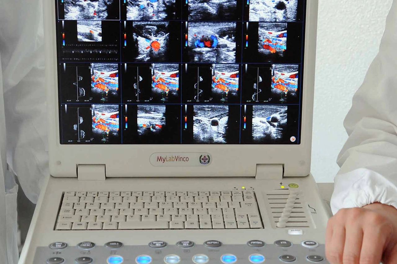 Ogni giorno in Lombardia 2 diagnosi di sclerosi multipla