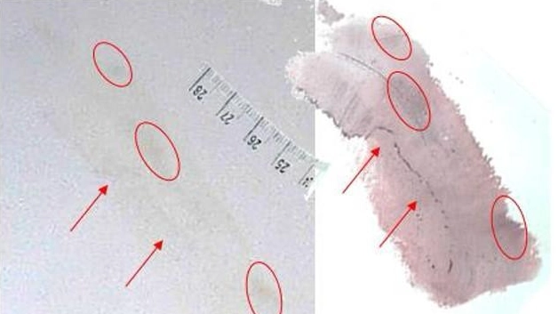 L'analisi dell'impronta 33 nella consulenza di parte della famiglia di Chiara Poggi: le 5 minuzie dattiloscopiche rilevate