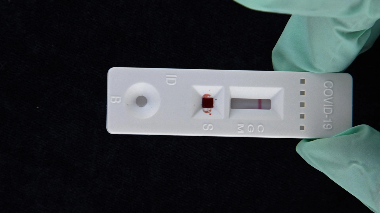 FILES-US-HEALTH-VIRUS-ANNIVERSARY