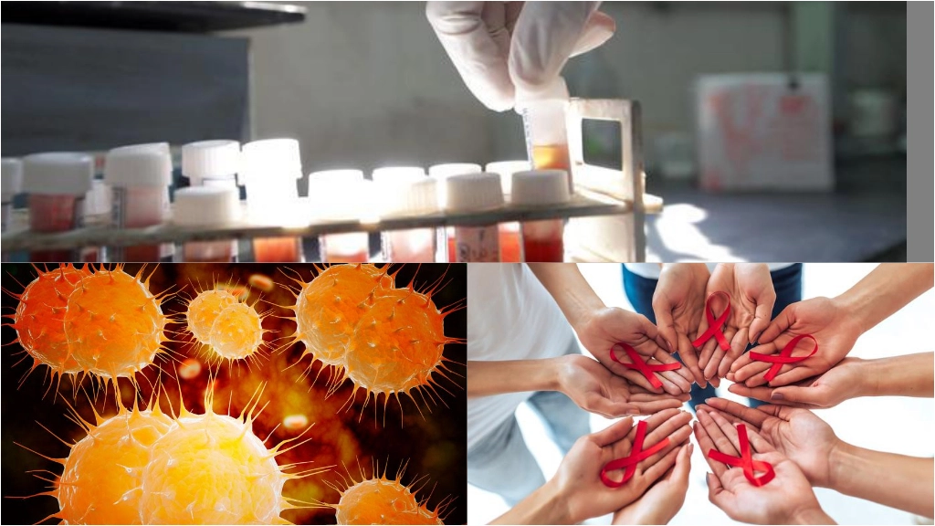 Crescono in Lombardia i casi di malattie sessualmente trasmissibili: dalla gonorrea alla clamidia, dalla sifilide all'Hiv
