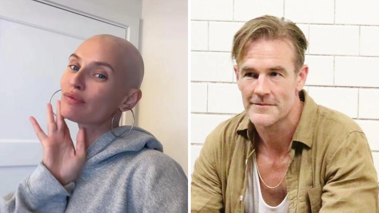 La modella Bianca Balti e l'attore James Van der Beek: a entrambi è stato diagnosticato un tumore La modella Bianca Balti e l'attore James Van der Beek: a entrambi è stato diagnosticato un tumore