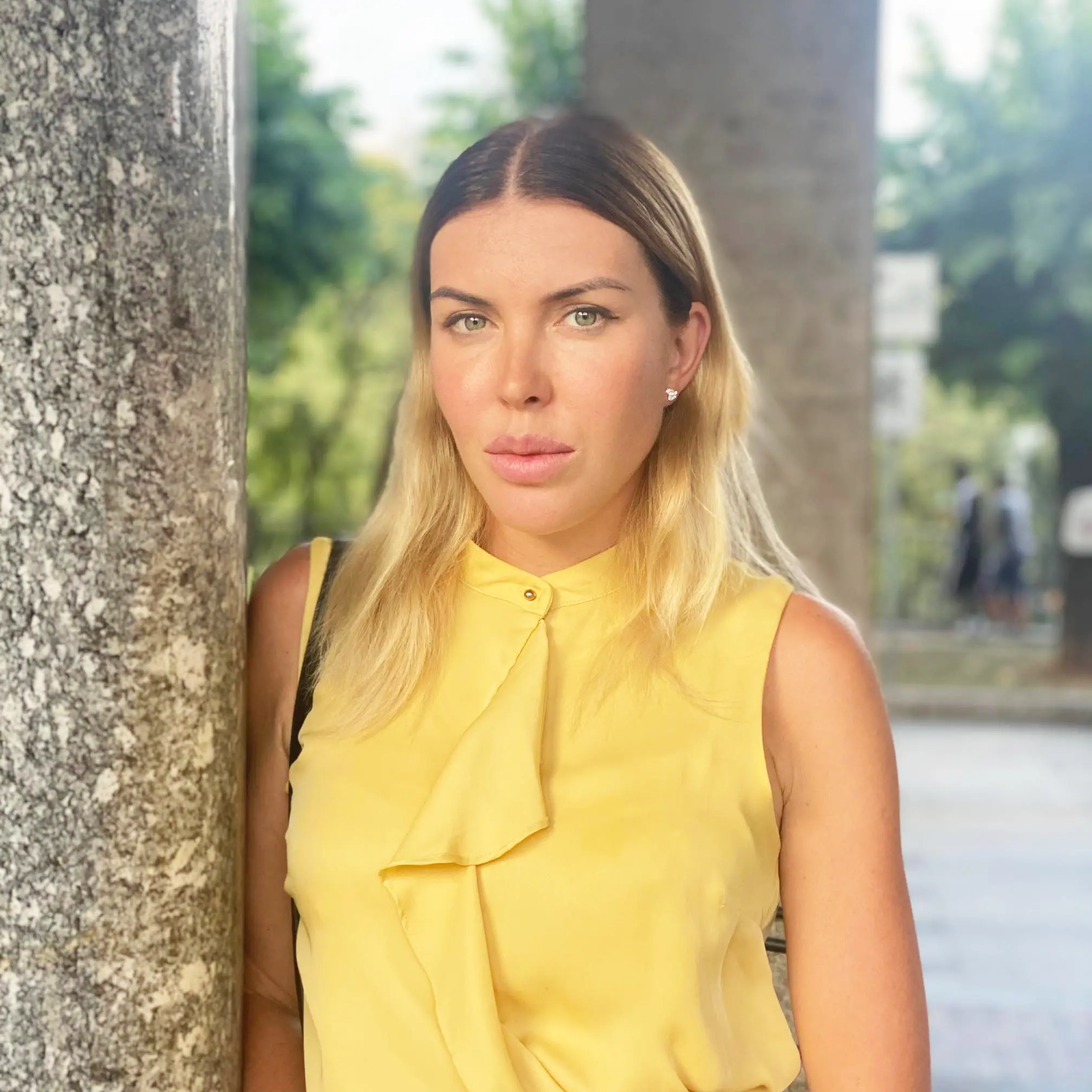 La strana storia di Anastasiya Zuevich, falsa chirurga estetica russa (già cittadina benemerita) travolta dalle accuse: “Donne rovinate da botox e filler”