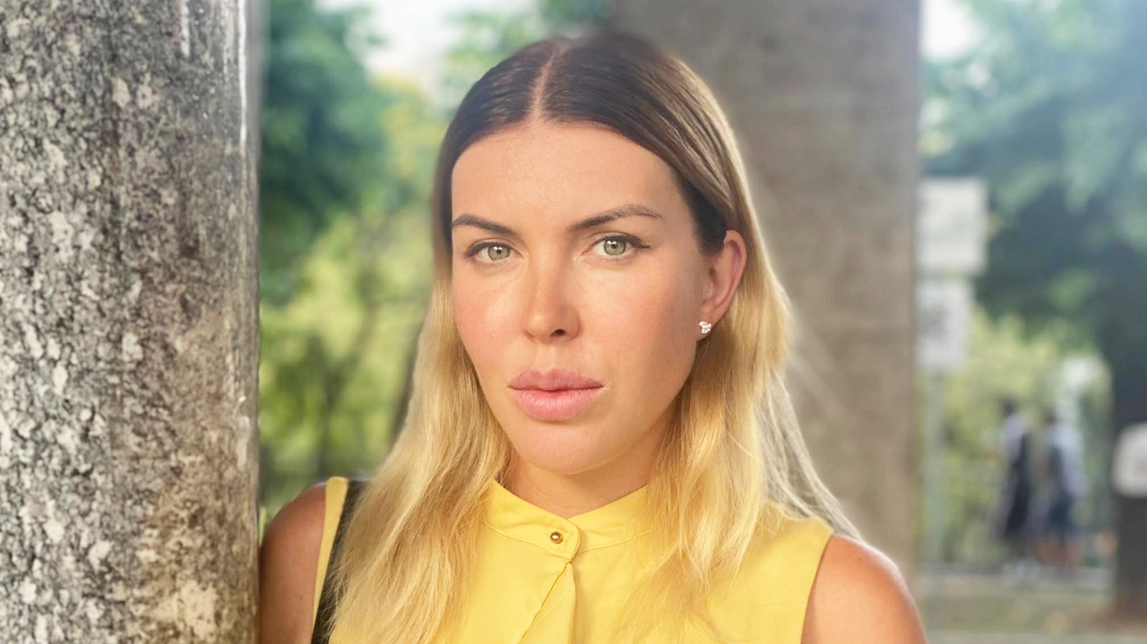 La strana storia di Anastasiya Zuevich, falsa chirurga estetica russa (già cittadina benemerita) travolta dalle accuse: “Donne rovinate da botox e filler”