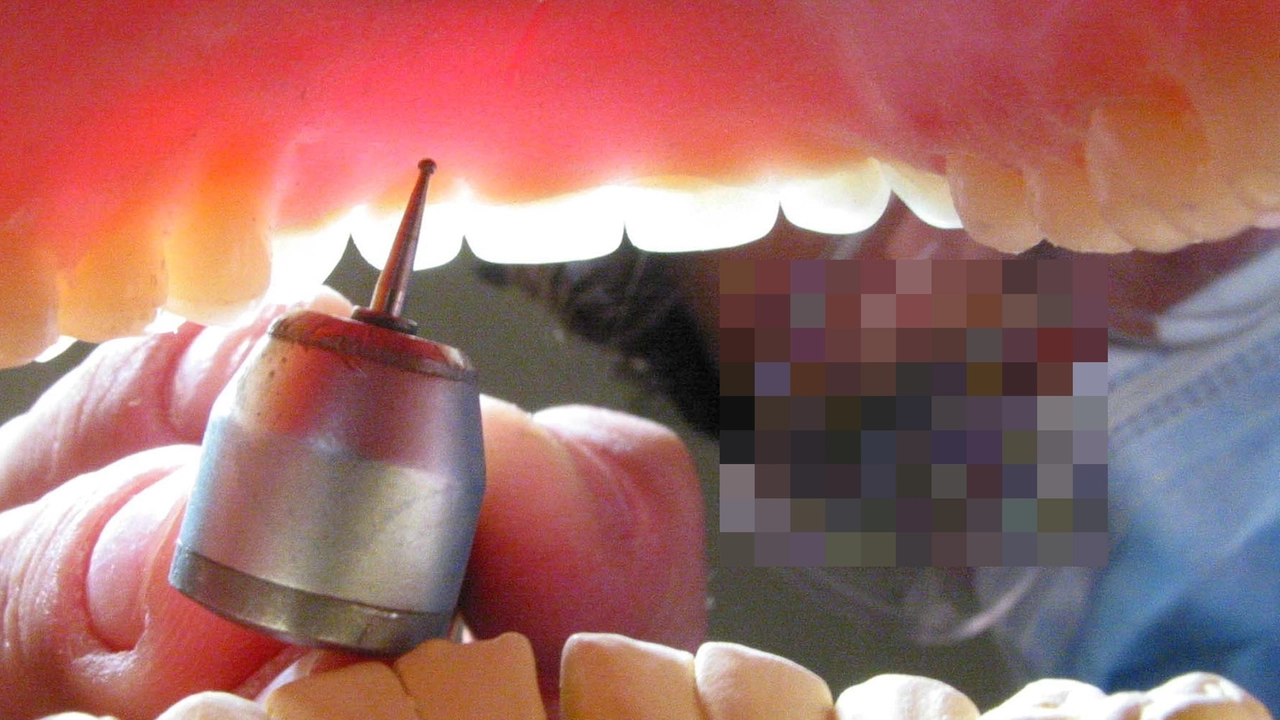 Denti Denti