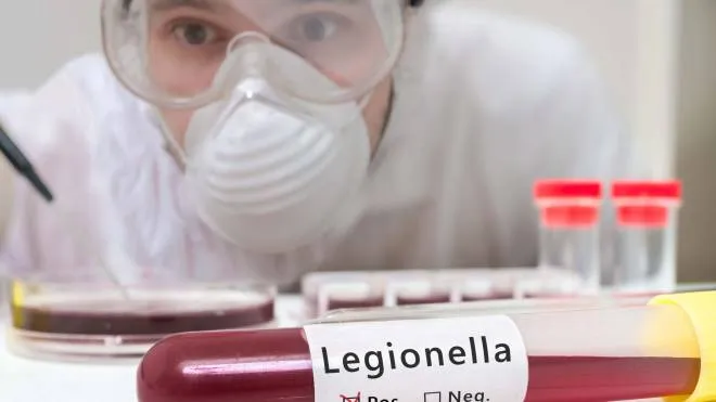 Lucidi Researcher is analyzing Legionella in test tube with blood. iStockphoto
