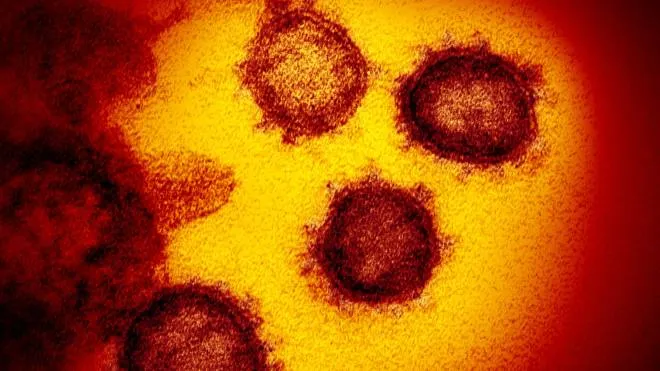 epa08252658 An undated handout picture made available by the National Institutes of Health (NIH) shows a transmission electron microscope image of SARS-CoV-2 -- also known as 2019-nCoV, the virus that causes COVID-19 -- isolated from a patient in the USA, emerging from the surface of cells cultured in the lab (issued 27 February 2020). The novel coronavirus is on the verge of spreading across the world as more cases are emerging outside China with outbreaks in South Korea, Italy and Iran.  EPA/NIAID- RML/NATIONAL INSTITUTES OF HEALTH HANDOUT  HANDOUT EDITORIAL USE ONLY/NO SALES