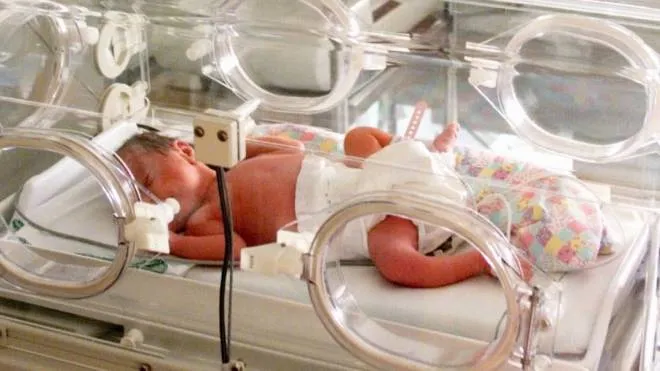 Foto Paolo Lazzeroni-Siena-:Bambini dentro ad una incubatrice