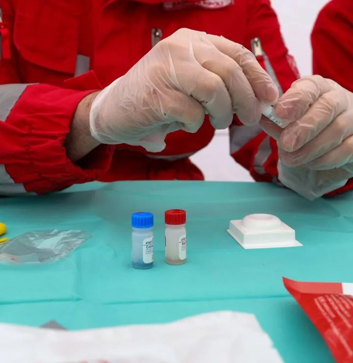 A Brescia sarà possibile effettuare test gratuiti di HIV