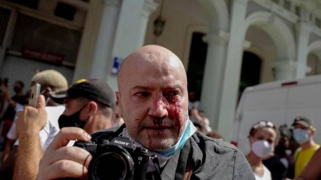Il fotografo dell'agenzia AP Ramon Espinosa ferito durante gli scontri