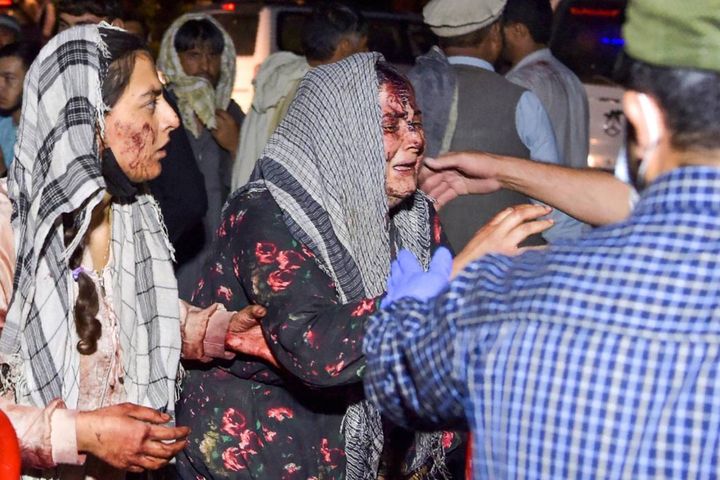 Due donne, ferite nell'attentato di Kabul, arrivano all'ospedale