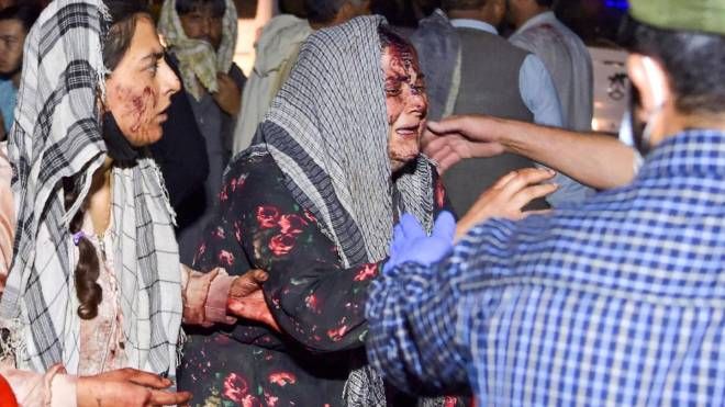 Due donne, ferite nell'attentato di Kabul, arrivano all'ospedale